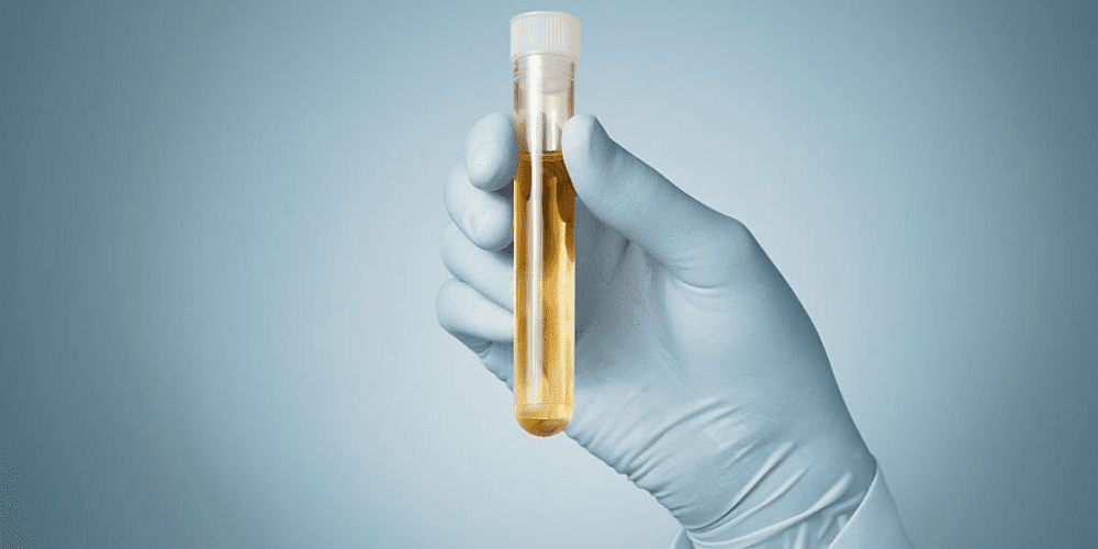 revolutionizing-drug-screening:-unveiling-12-panel-now's-18-panel-urine-test